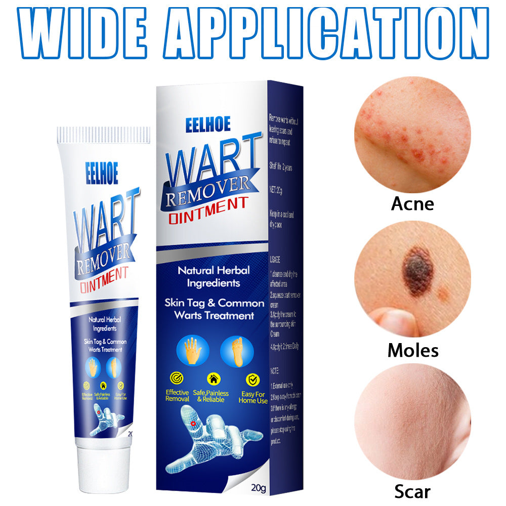 Skin care lotion Wart Removing Cream