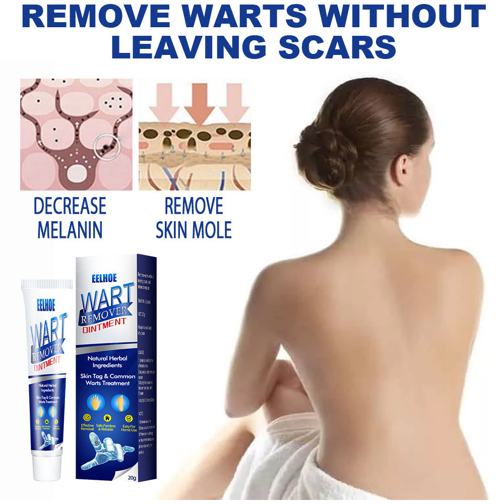 Skin care lotion Wart Removing Cream