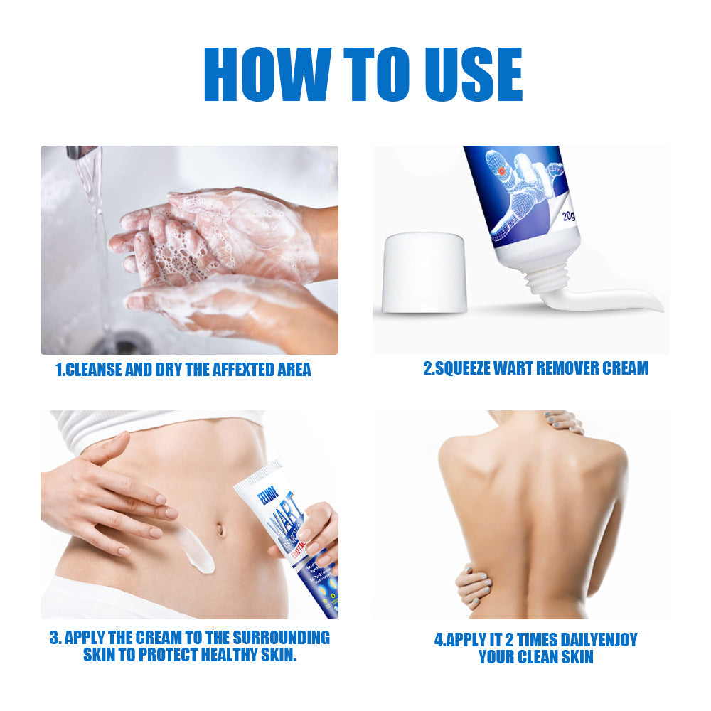 Skin care lotion Wart Removing Cream